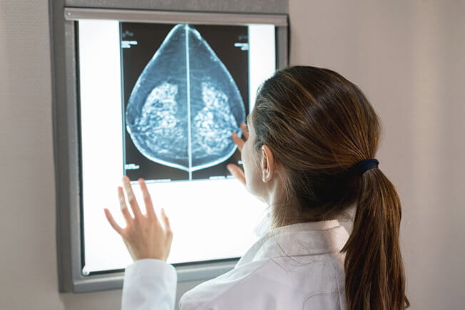 Clinician reviews mammogram film