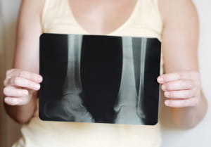 woman holding X-ray of lower legs